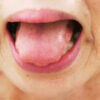 舌の筋肉を鍛えたらアトピー、うつが改善　毎日のあいうべ体操で : yomiDr./ヨミドク